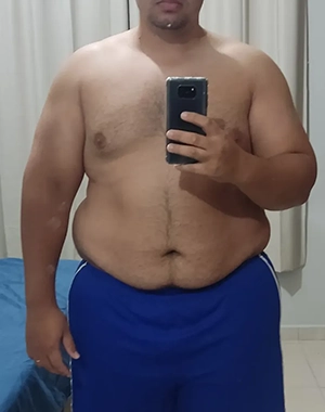 Carlos antes do processo de emagrecimento